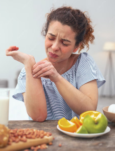 alergia-a-alimentos-causas-sintomas-diagnostico-y-tratamiento imagen de artículo