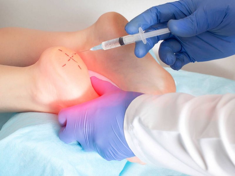 Factores de Crecimiento en Pie