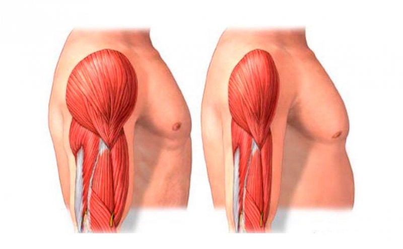 Sarcopenia 