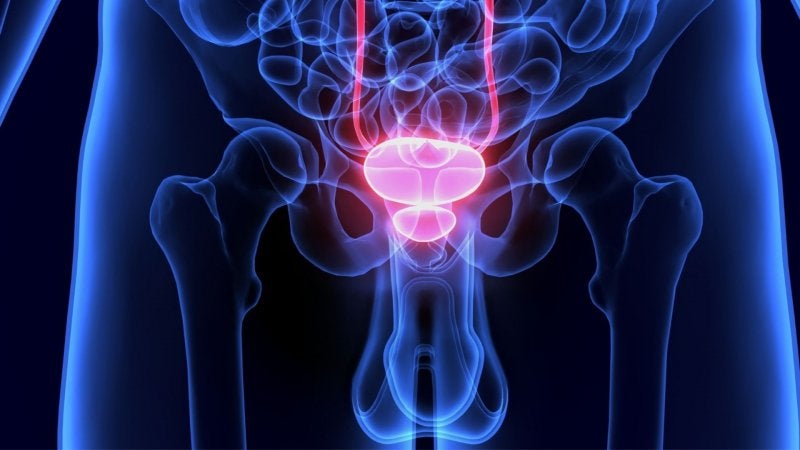 cáncer-de-próstata