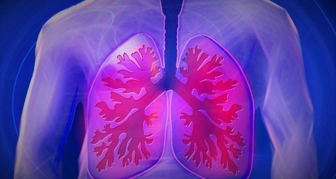 enfermedad pulmonar intersticial
