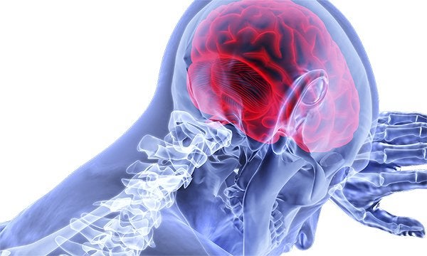 Neurocirugía Mínimamente Invasiva Cerebral y de Base de Cráneo?