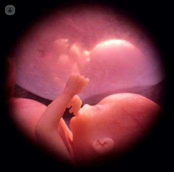 asfixia perinatal 