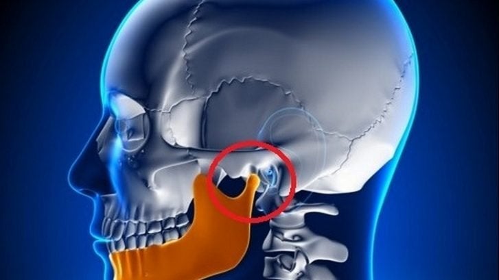 Tratamiento de la Articulación Temporomandibular