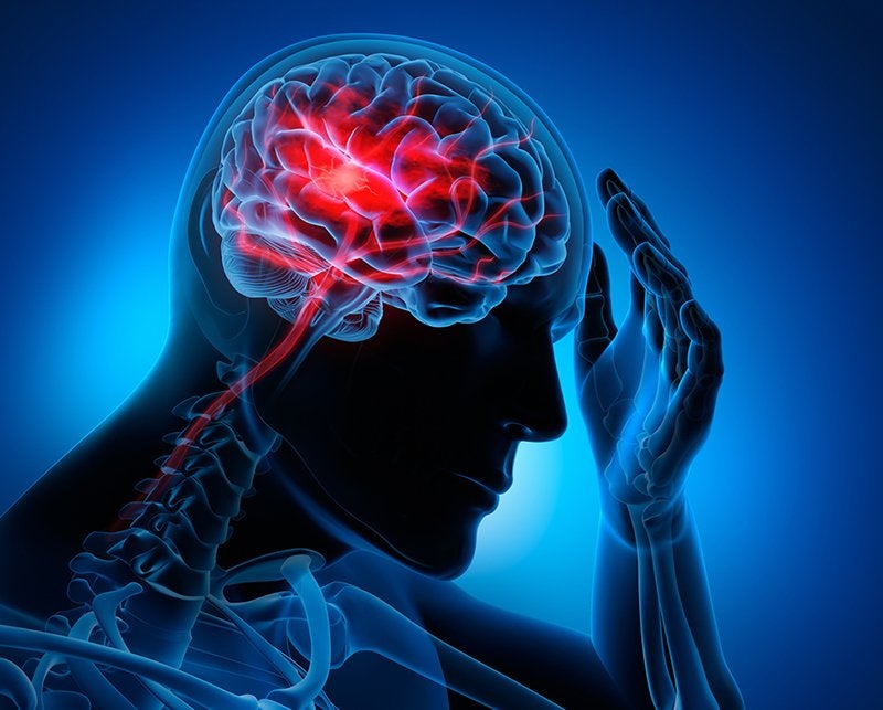 Accidente Cerebrovascular: qué es, síntomas y tratamiento | Top Doctors