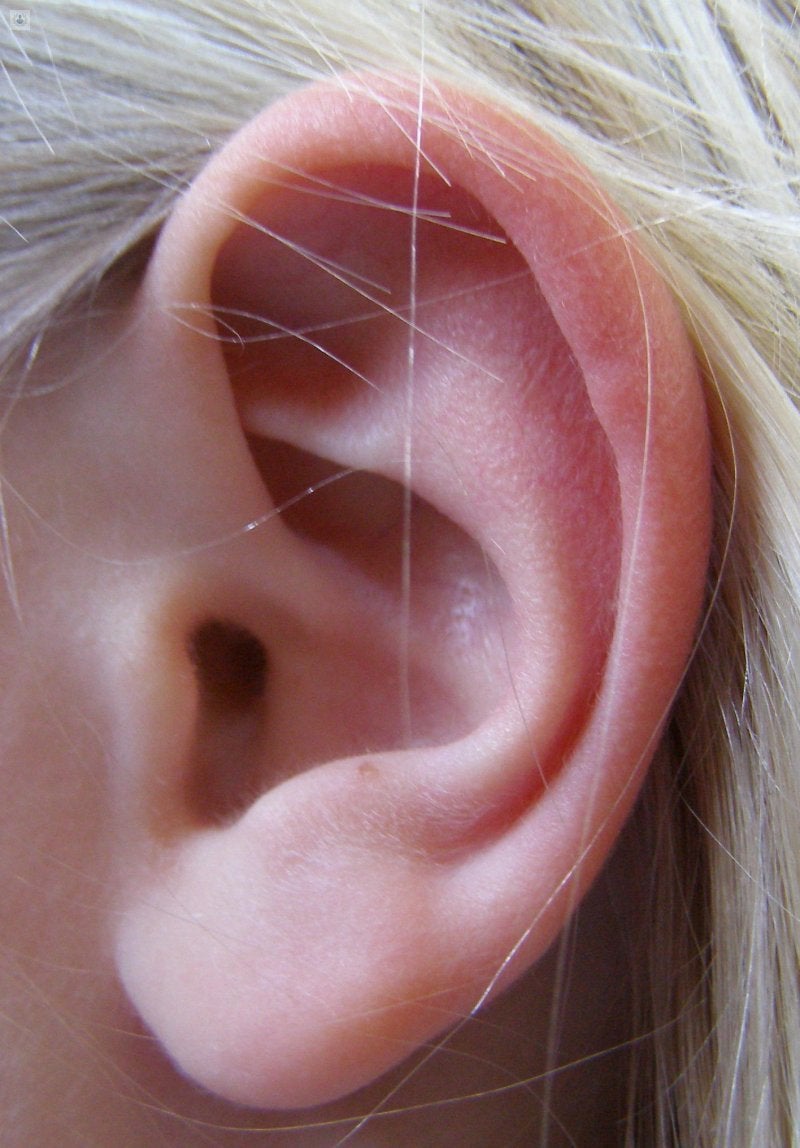 cirugia de orejas