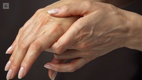 artritis reumatoide juvenil