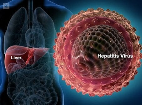 hepatitis viral