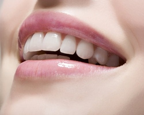 Beneficios de las Carillas Dentales para lucir una bella sonrisa