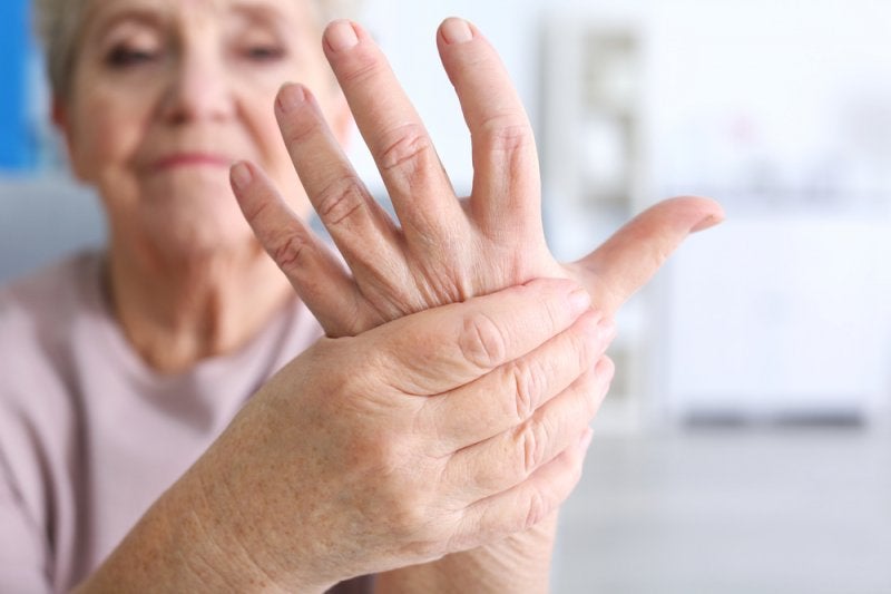 Artritis-Reumatoide