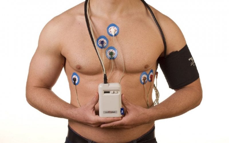Electrocardiograma Ambulatorio Holter