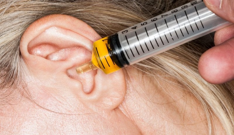 Limpieza de Oídos: qué es, síntomas y tratamiento