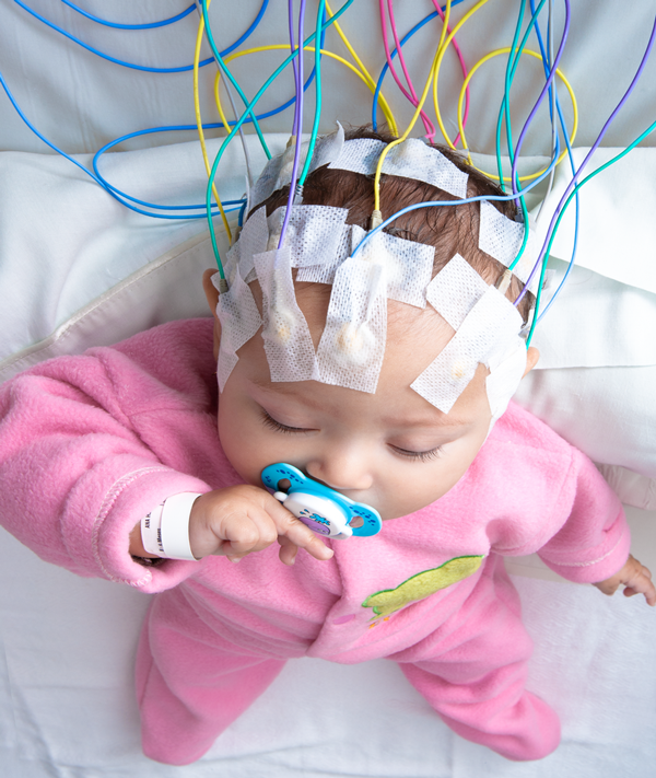 Neurología Infantil