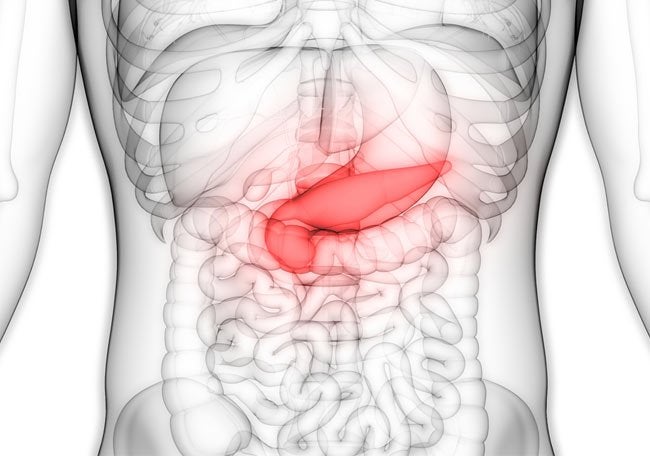 pancreatistis-crónica