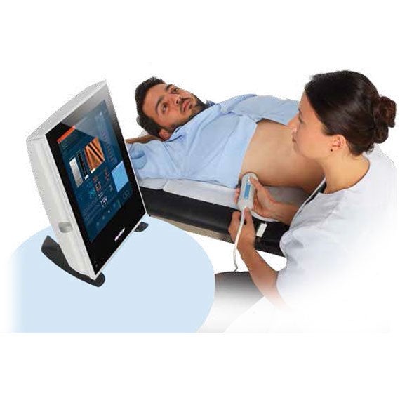 FibroScan 