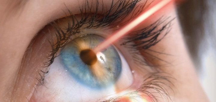 Cirugia ojos