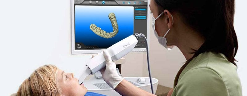 Impresión Dental Digital