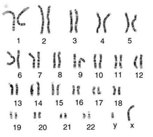 Alteraciones Cromosómicas