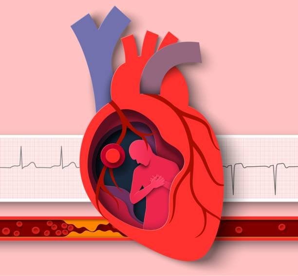 Enfermedad cardiovascular: Tipos, síntomas y prevención