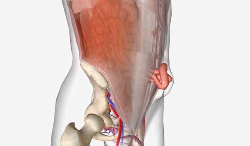 Hernia abultada