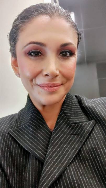 Dr. Denice Ovalle Prueba 